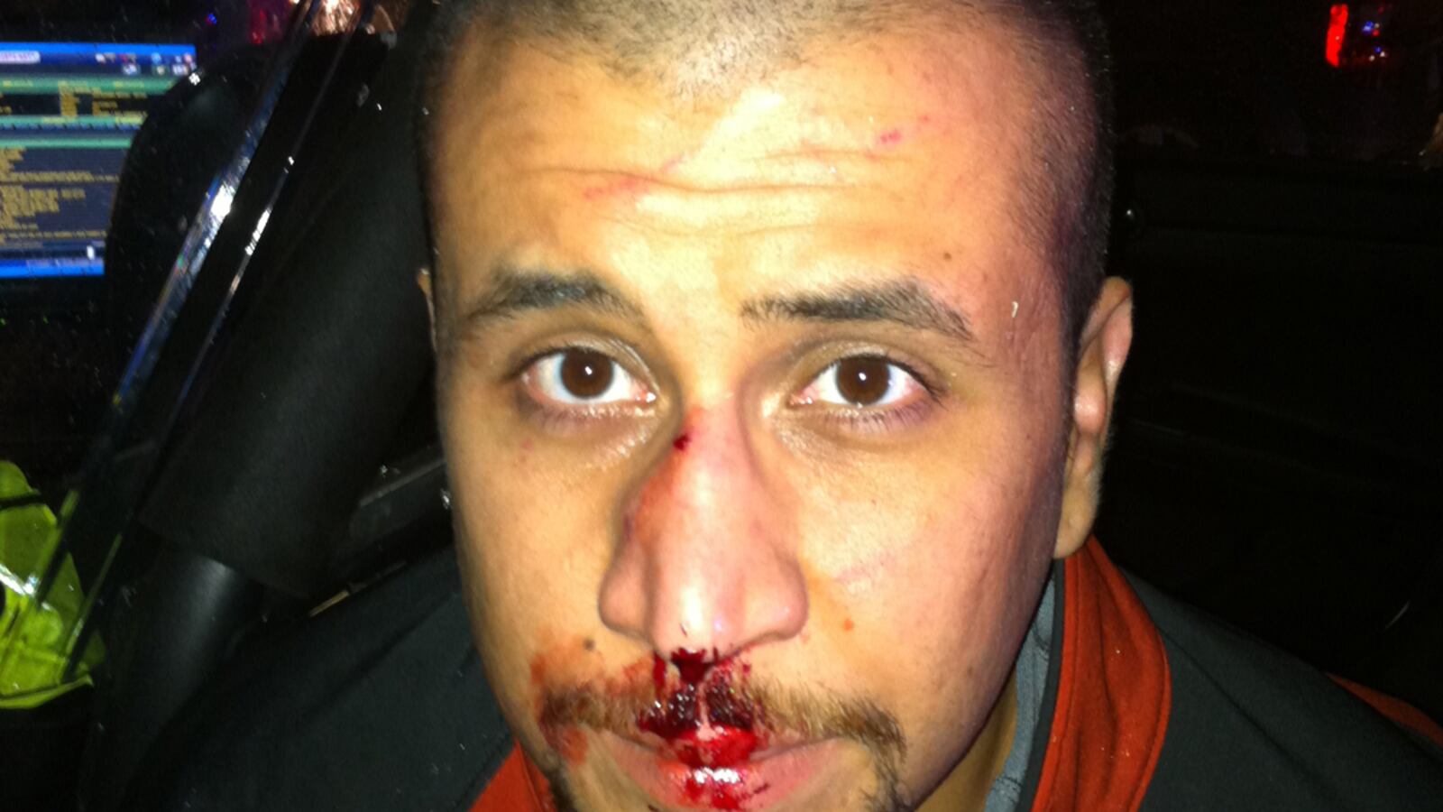 cheats/2012/12/04/lawyers-look-at-zimmerman-s-bloody-nose/george-zimmerman-tease_sub1mg