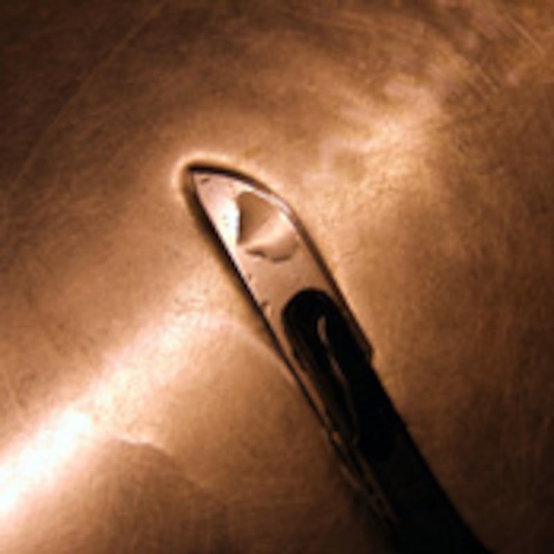 articles/2010/05/20/ayaan-hirsi-ali-on-injustice-of-female-genital-mutilation/ali-female-circumcision_102103_lyilci