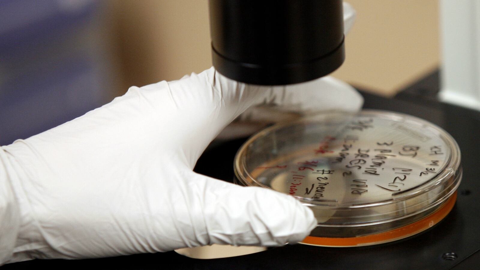 gonorrhea-superbug_xdep9c