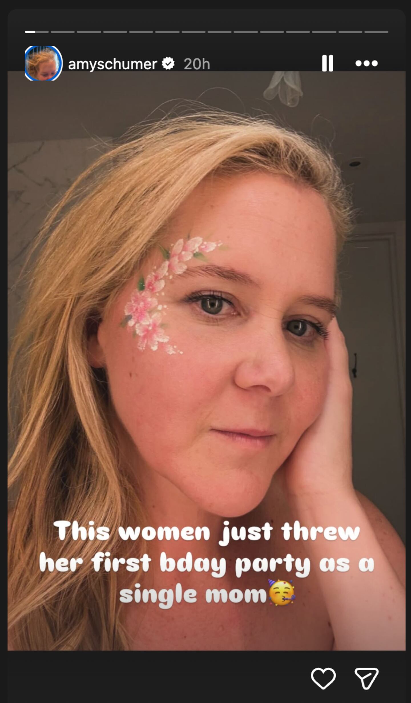 ‘Single Mom’ Amy Schumer Marks Major Post-Divorce Milestone