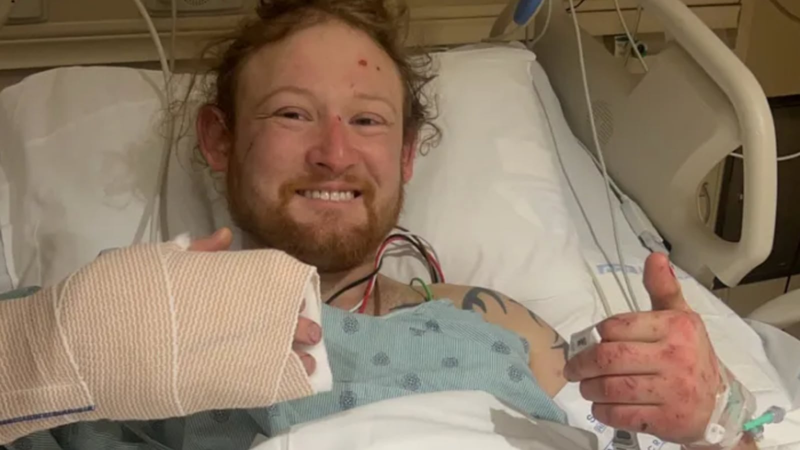 A smiling Matthew Reum gives a thumbs up from his hospital bed.