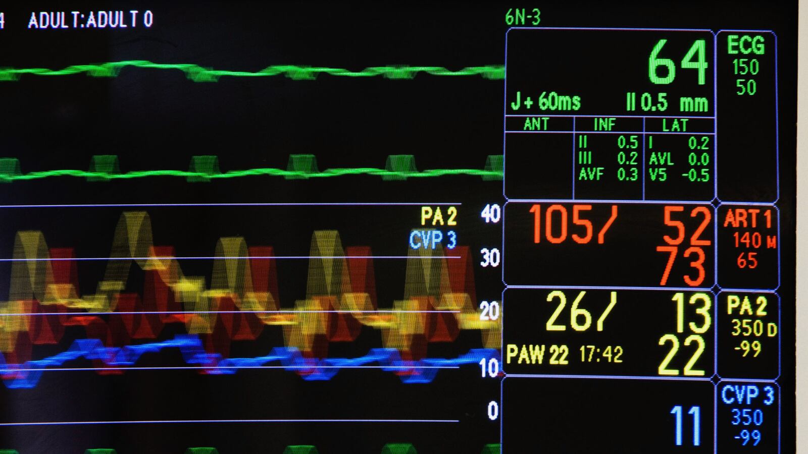 cheats/2014/01/24/judge-cut-woman-s-life-support/140124-life-support-cheat_ep6r34