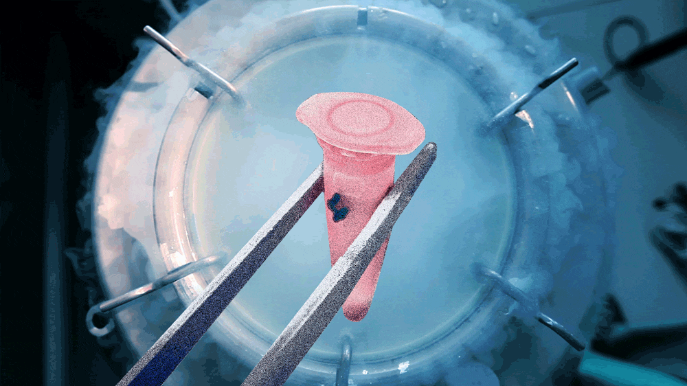 190612-Watts-freezing-sperm-tease_d12nwa