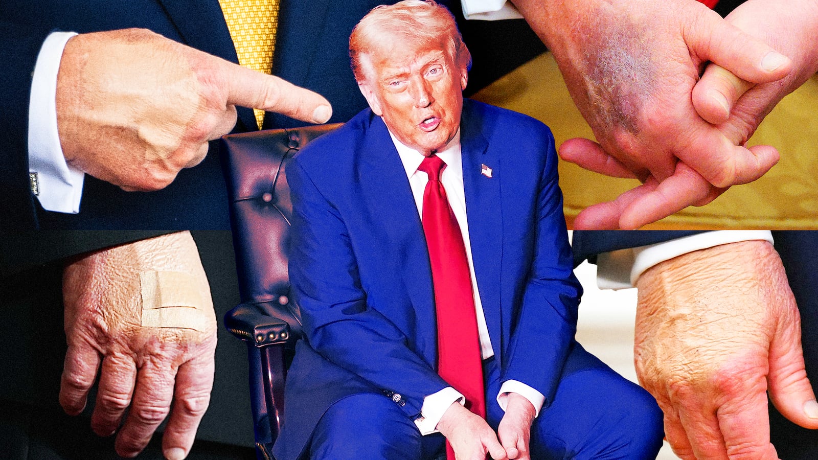 A photo collage of Donald Trump's bruised hands throughout the year.