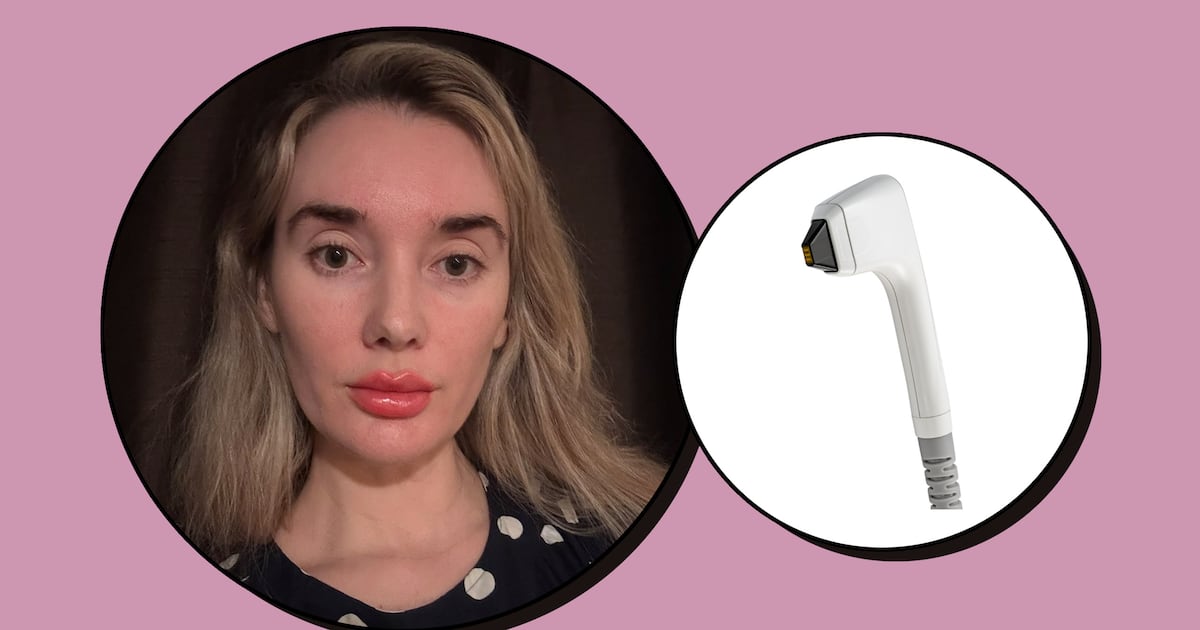 I Tried Sofwave, a Non-Invasive Skin Tightening Treatment, and My Cheekbones Have Never Looked More Snatched