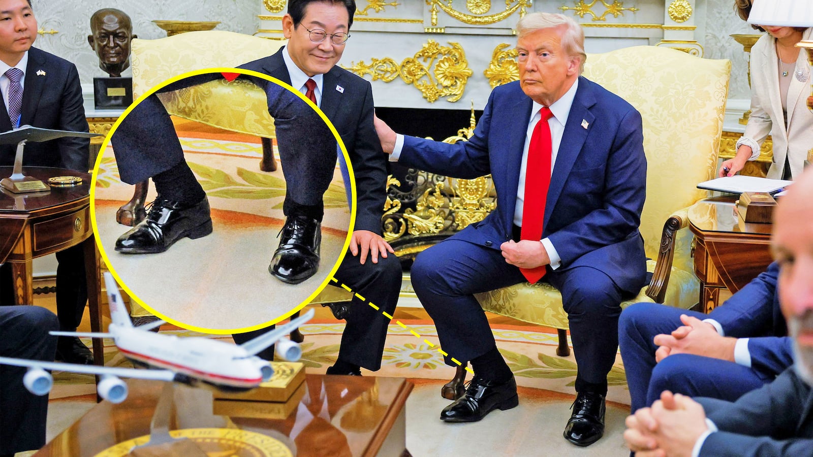 Trump was diagnosed with chronic venous insufficiency after questions arose about his swollen ankles.