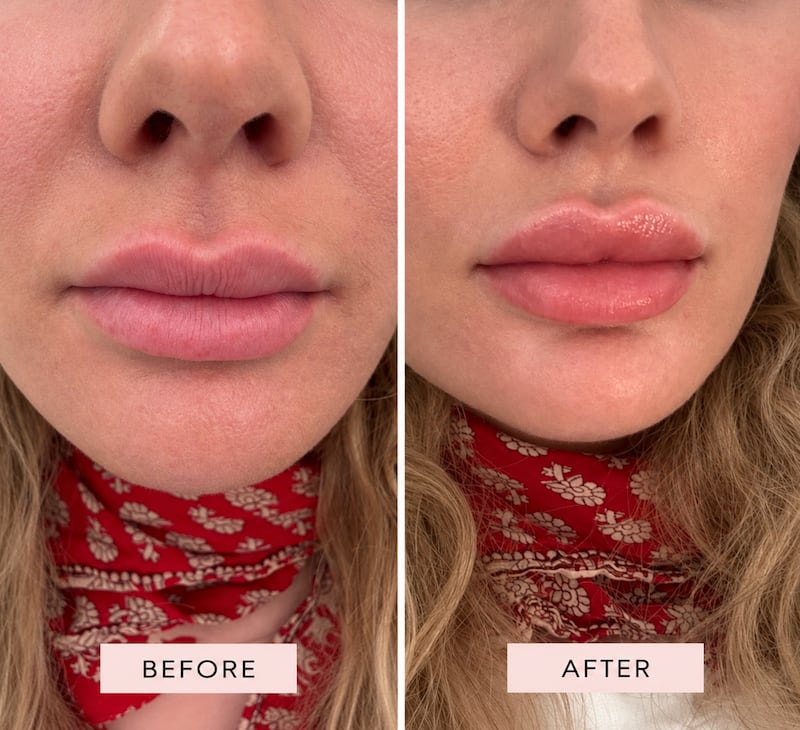 Lip blushing before and after