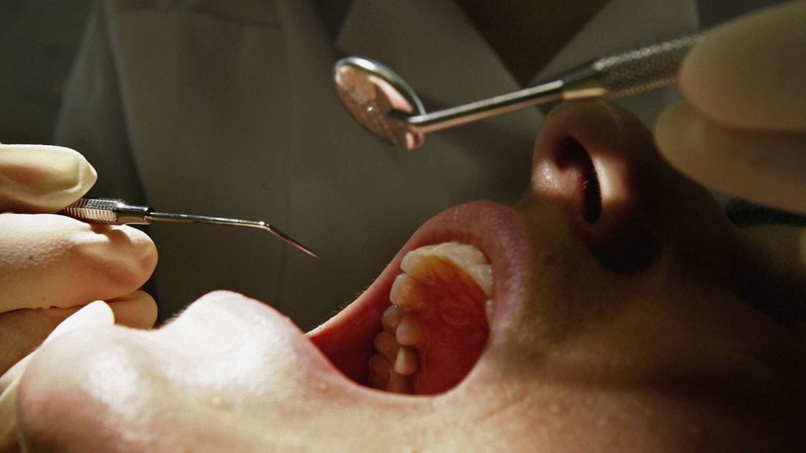 cheats/2012/05/09/dentist-revenge-story-a-hoax/dentist-stock-cheat_zydgam