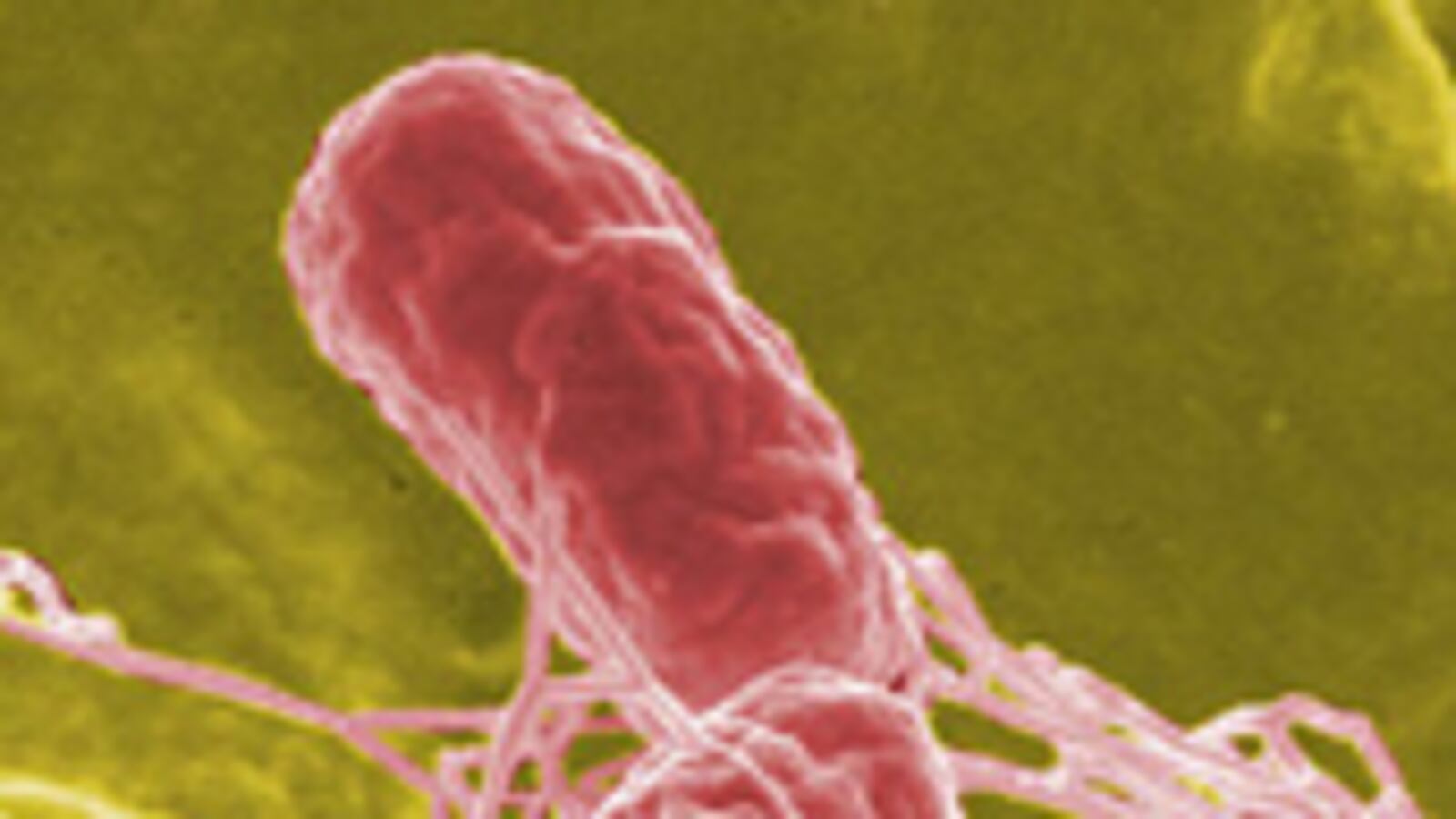 articles/2010/08/17/egg-recall-and-salmonella-outbreak-symptoms-statistics-more/tdb-salmonella_120792_lxoqlx