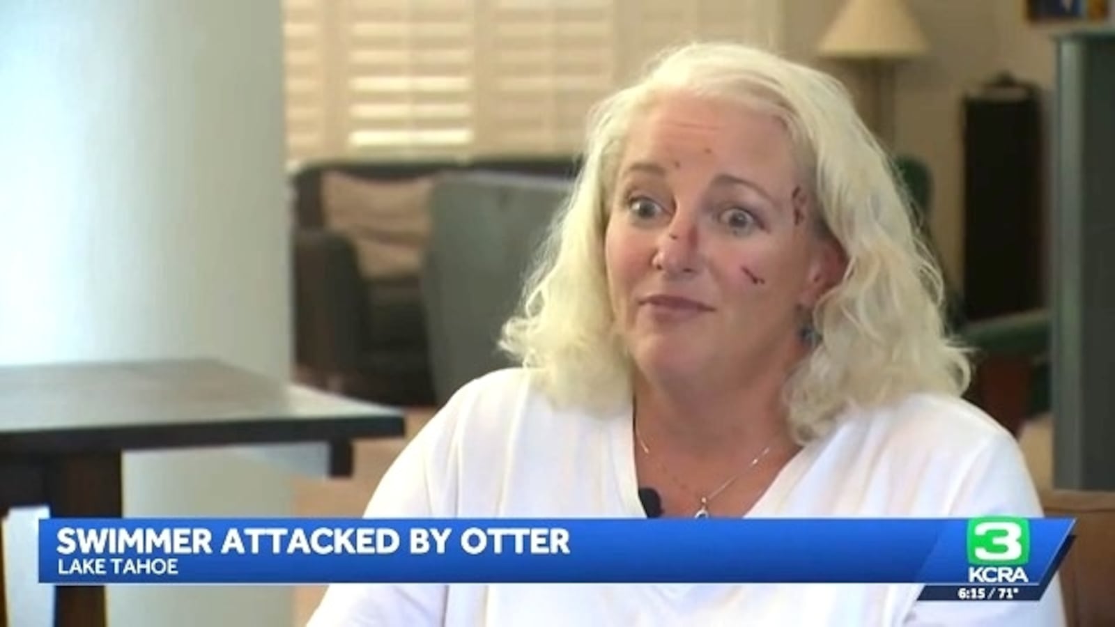 kcra