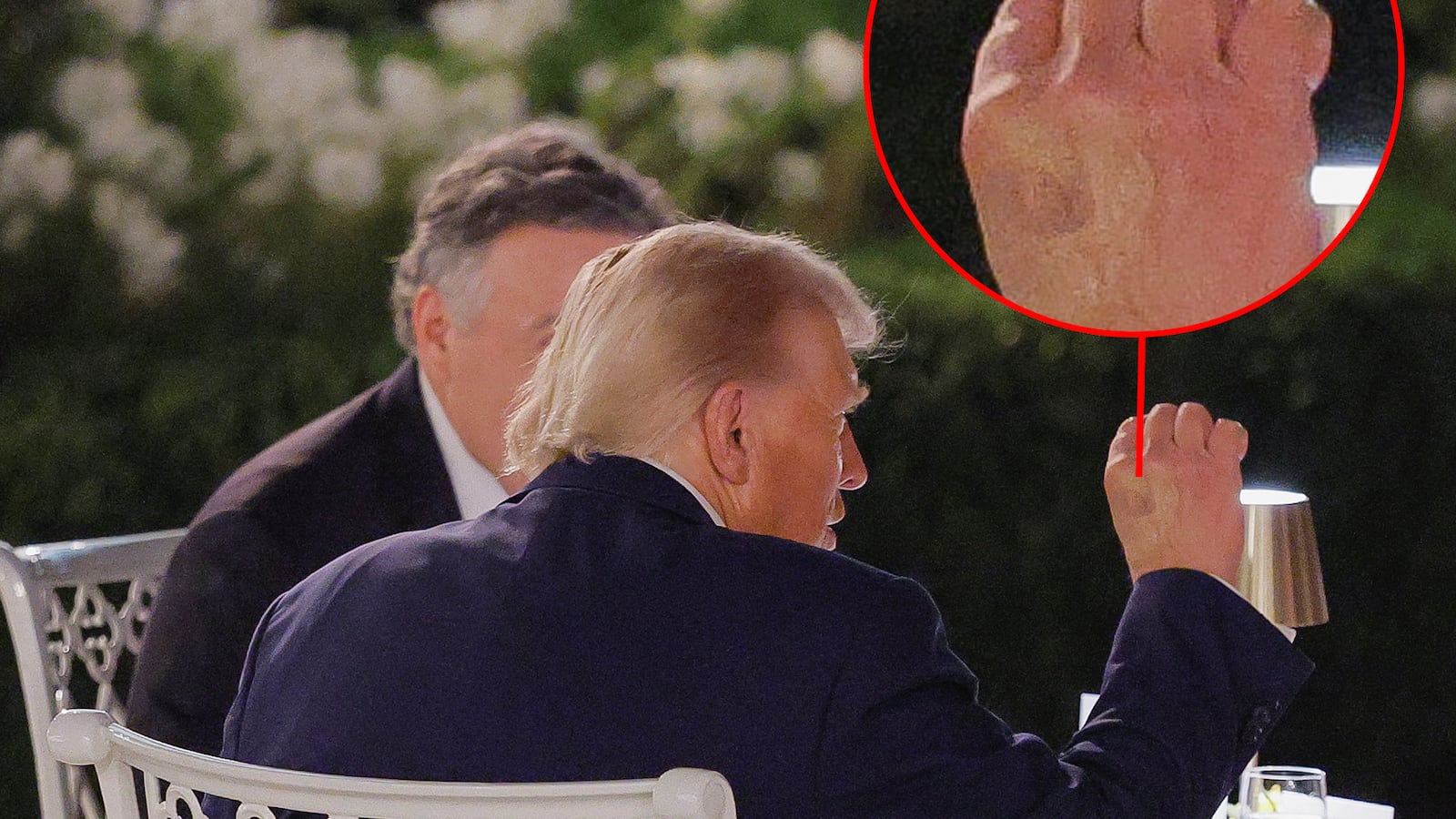 Discoloration is seen on Trump's right hand.