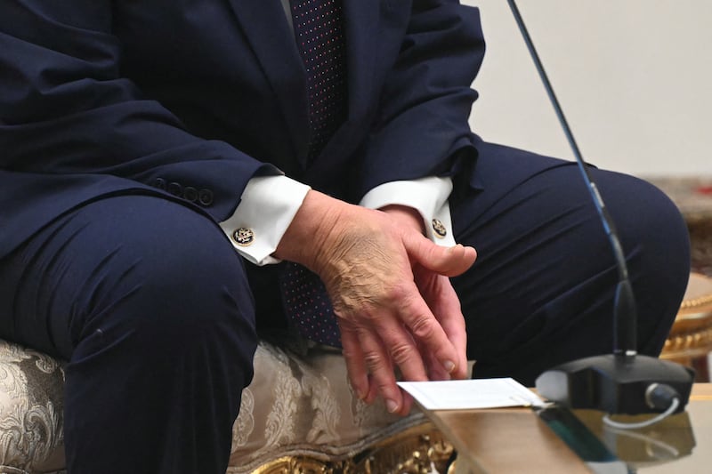 Trump's hands appeared sore and green-purple.