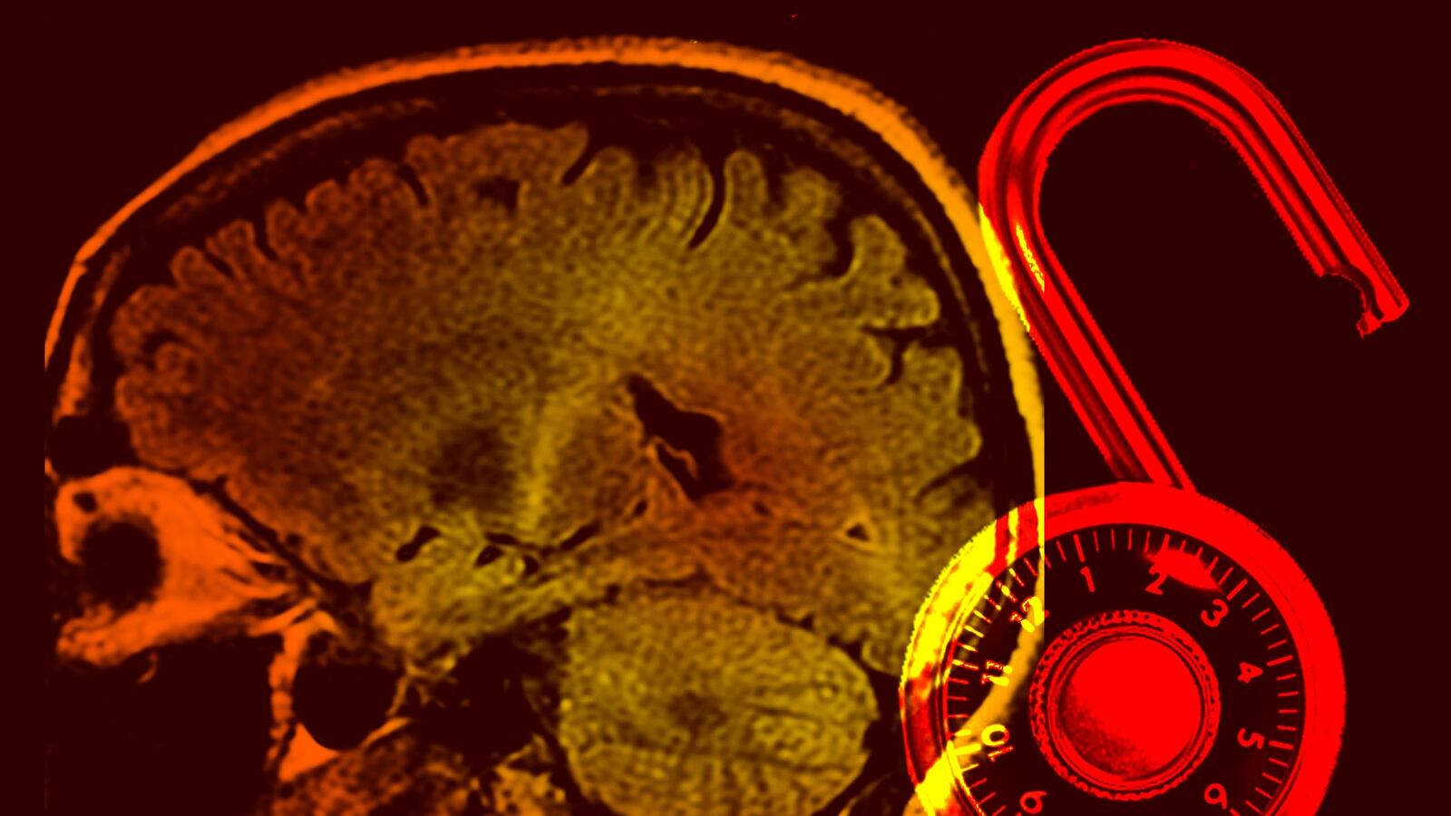 articles/2017/01/31/computer-lets-fully-paralyzed-patients-speak-for-first-time/170130-Azarian-als-lock-tease_hxuree