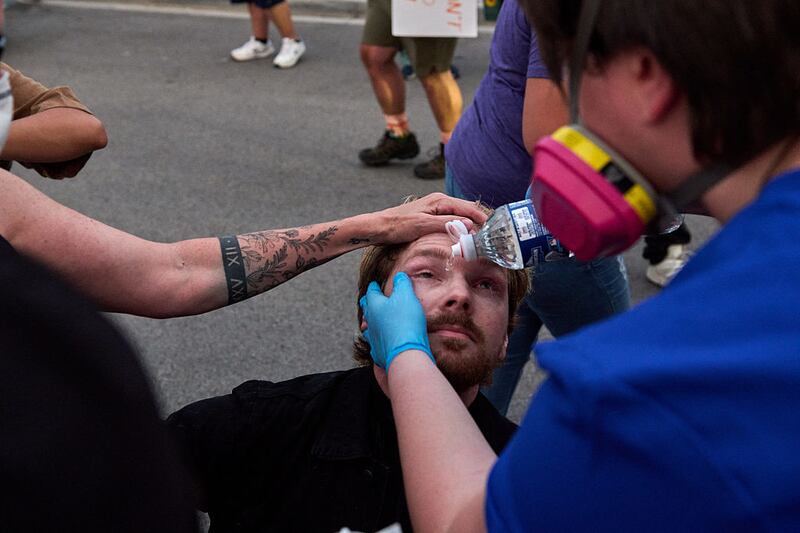 Protesters gathered outside of the suburban Chicago ICE Detention Center in Broadview, IL treat injuries sustained from repeated chemical weapons deployed by federal agents. Sept. 19, 2025.
