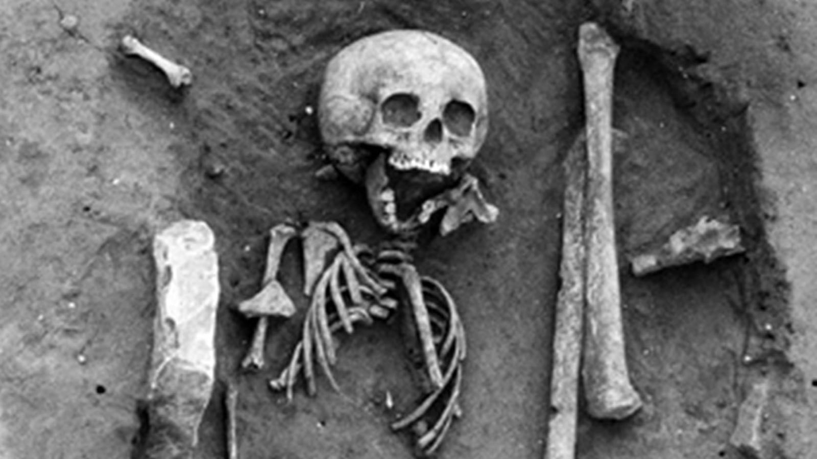 articles/2014/07/22/living-with-disability-in-the-dark-ages/140720-Picciuto-disabilities-tease_em28ae