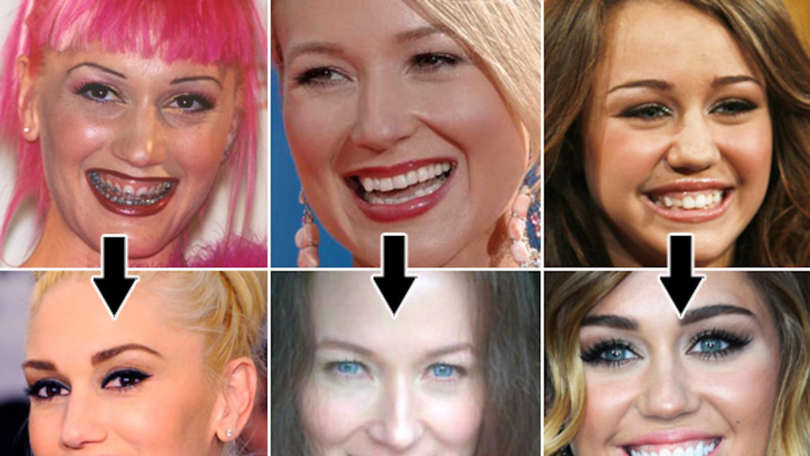 galleries/2012/06/08/jewel-lindsay-lohan-more-stars-who-fixed-their-teeth-photos/celebrity-teeth-fixers-tease_xkfodn