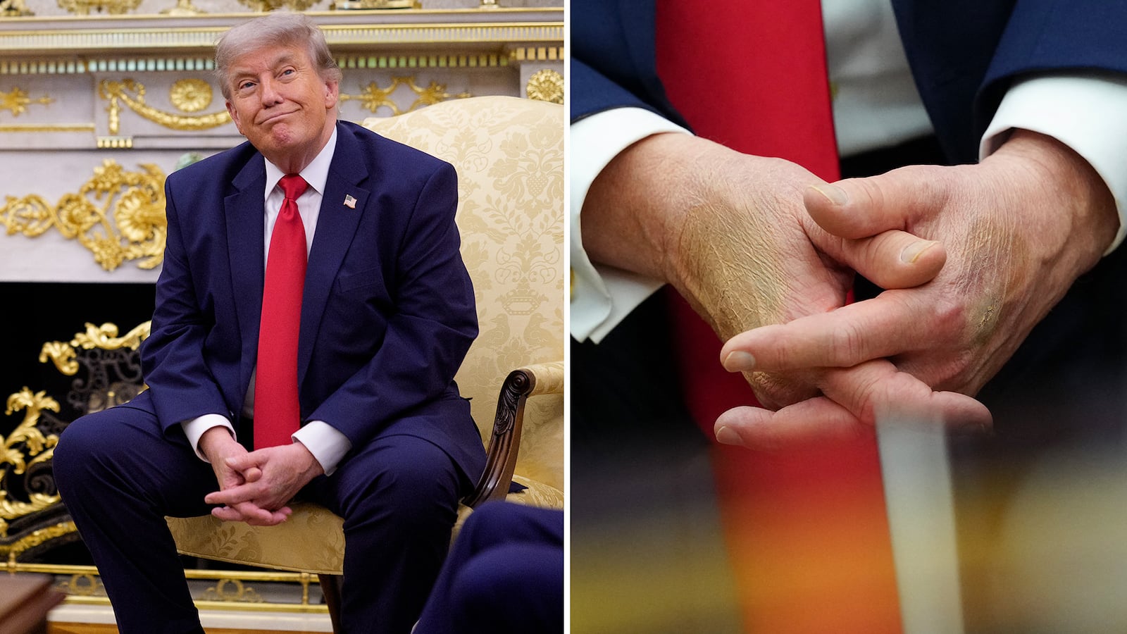 Donald Trump's hand on June 24, 2026