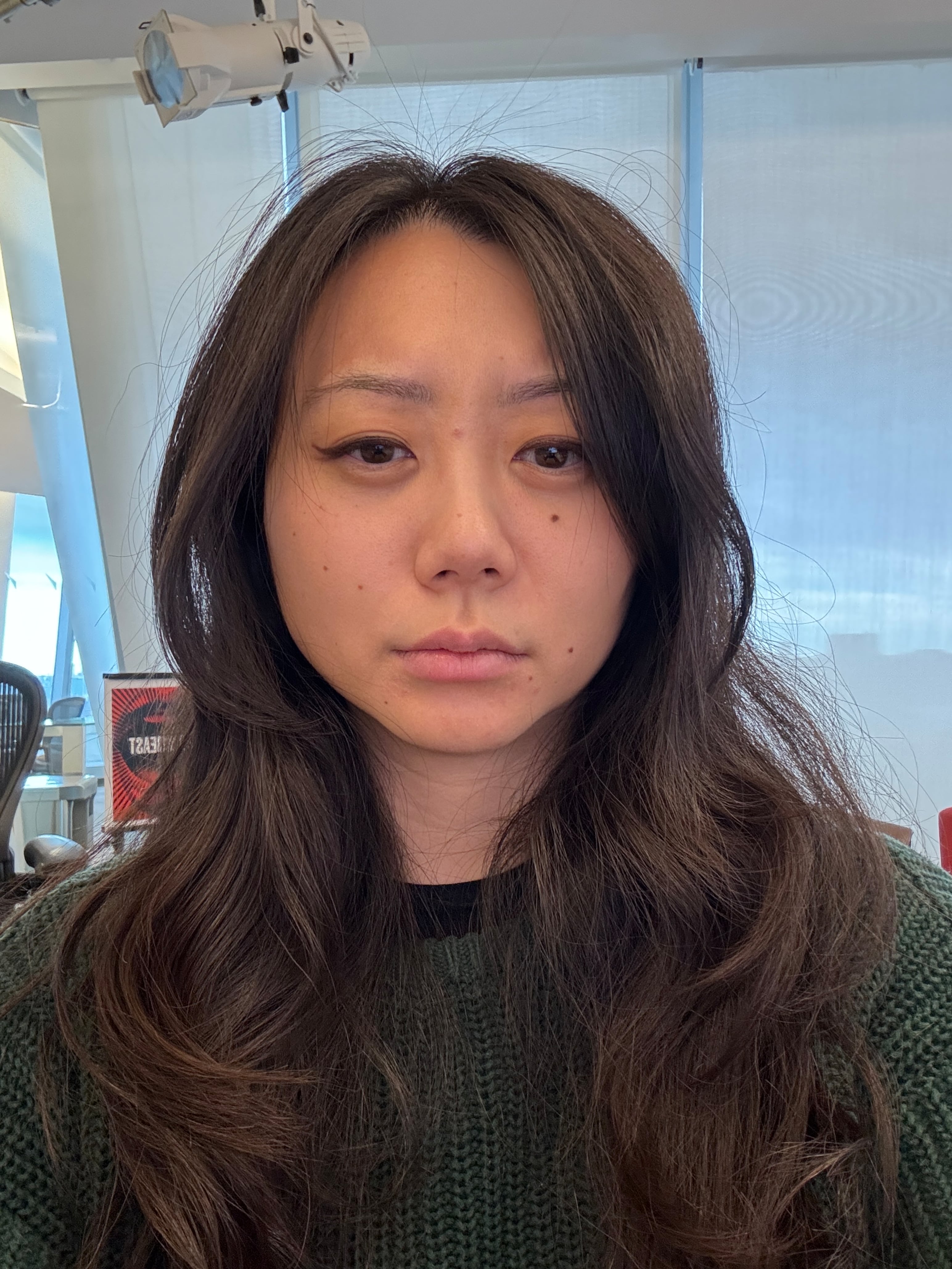 Frowning with baby botox.