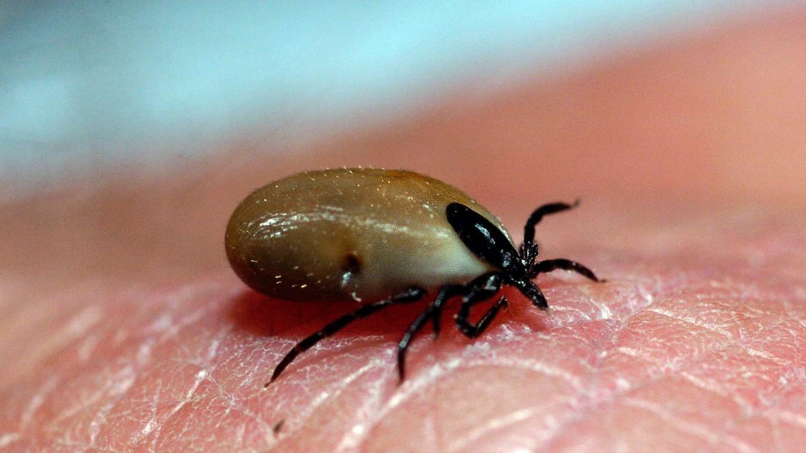 articles/2014/04/02/cases-of-new-tick-borne-illness-heartland-virus-grow/140401-sepkowitz-disease-tease_vt1ppw