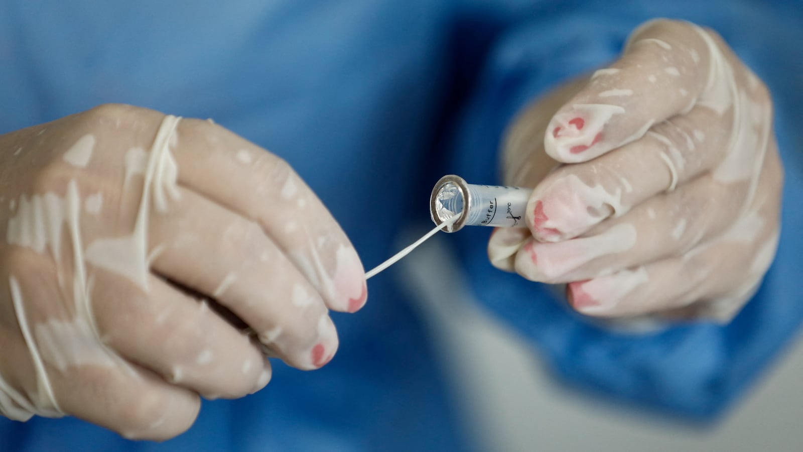 A health worker prepares a sample of test for the coronavirus disease.