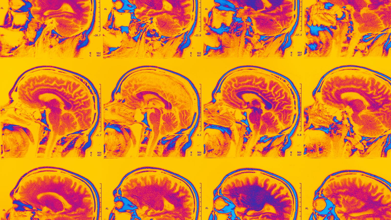 220725-schizophrenia-tease-01_nmkq3d