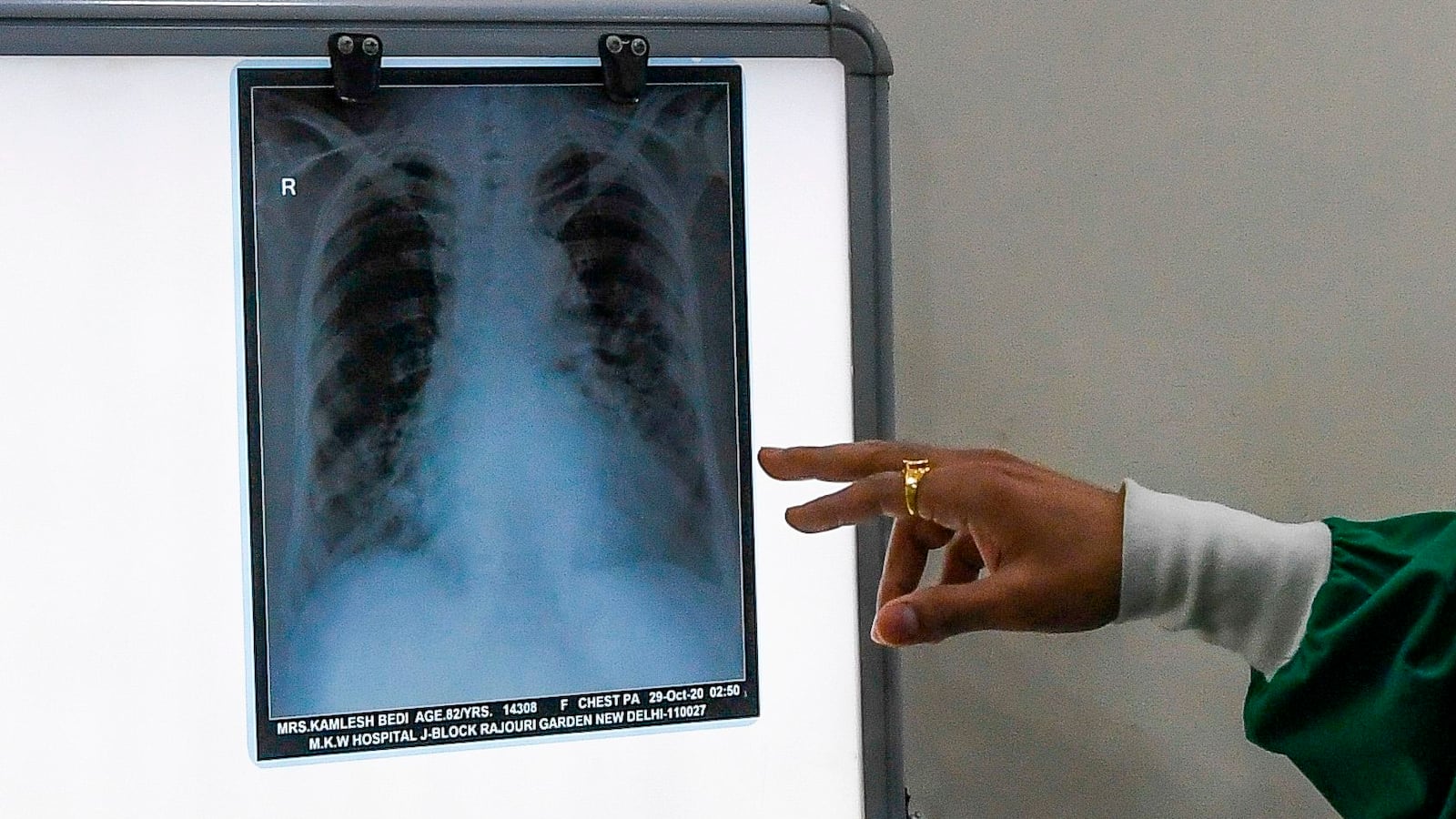 GettyImages-1229521185_yq8gqt