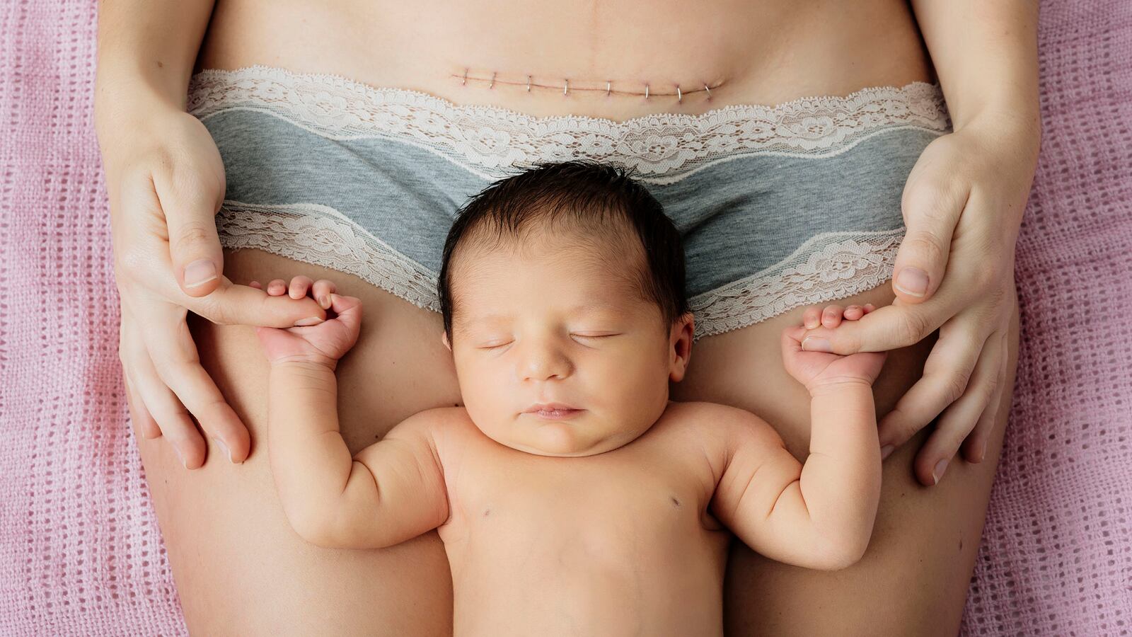 190110-McPherson-gentle-c-section-tease_zvyfrz