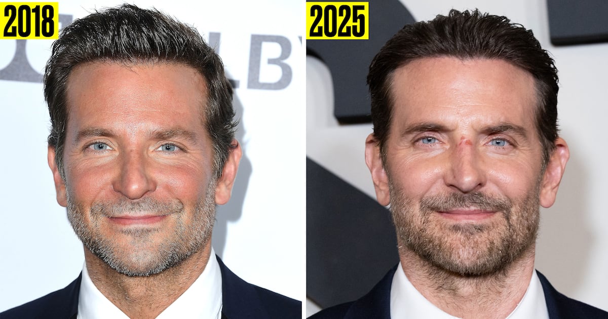 Bradley Cooper, 51, Addresses Plastic Surgery Rumors