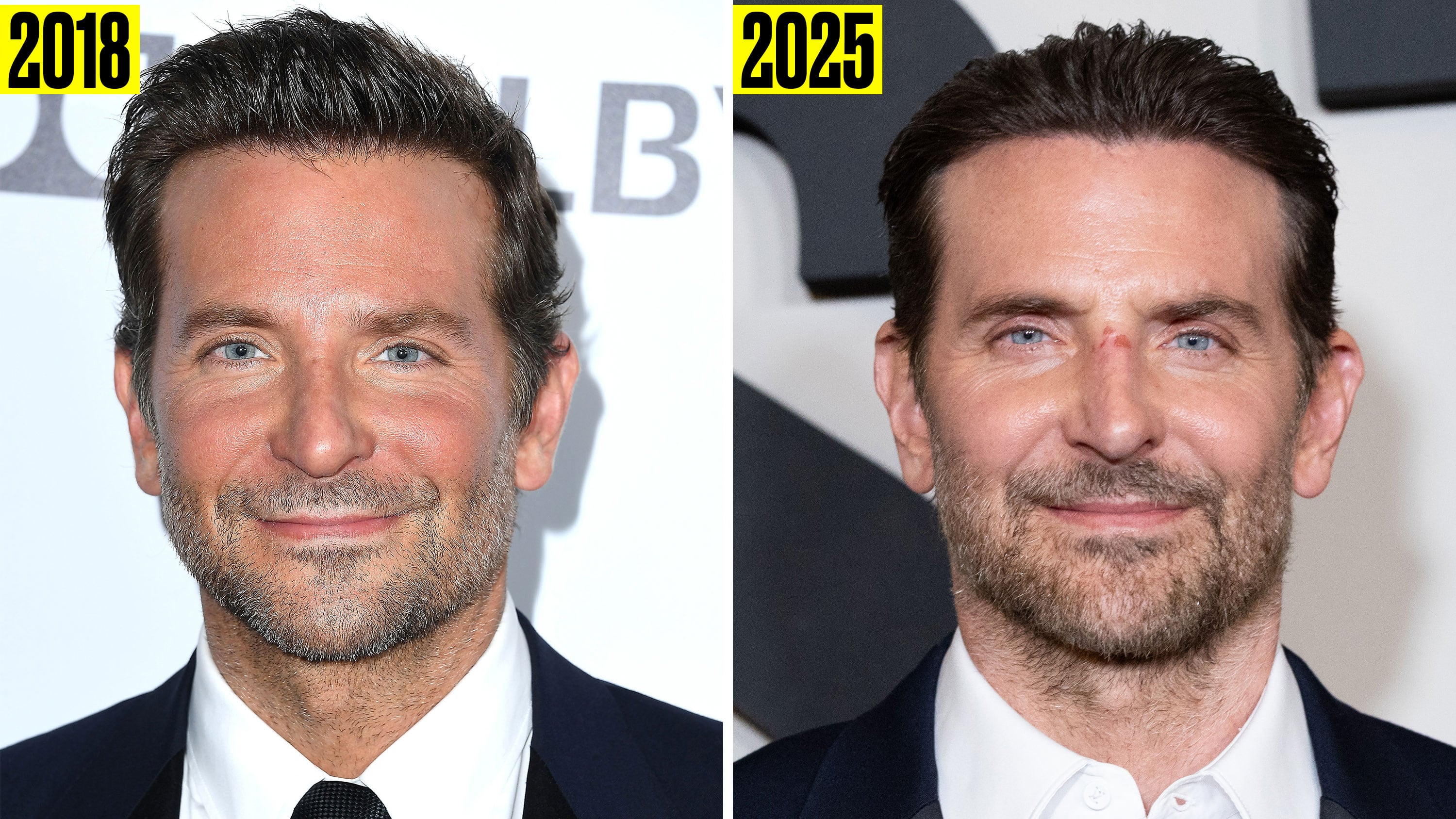 Bradley Cooper in 2018 and 2025