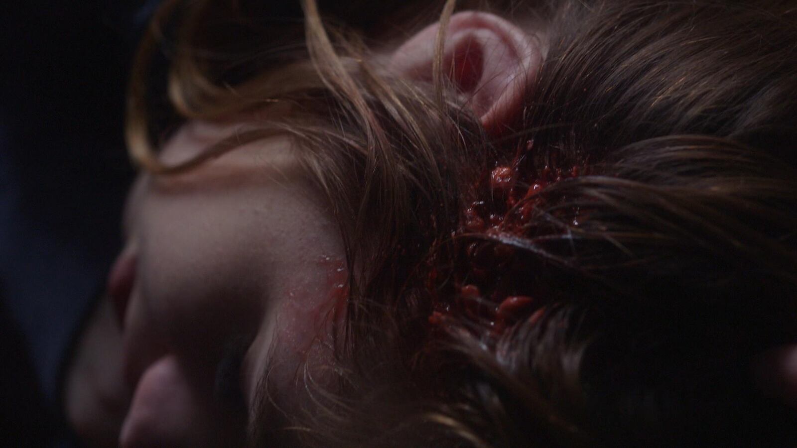 Blooded hair with puss coming out of the skull.