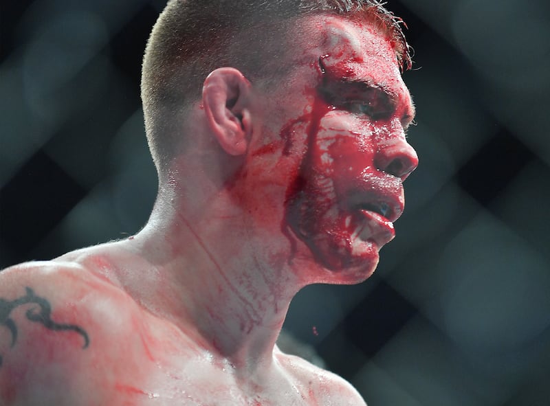 LAS VEGAS, NV - JULY 07: Blood drips down Paul Felder's face as he stands in the octagon during his welterweight fight against Mike Perry at T-Mobile Arena on July 7, 2018 in Las Vegas, Nevada. Perry won by split decision. (Photo by Sam Wasson/Getty Images)