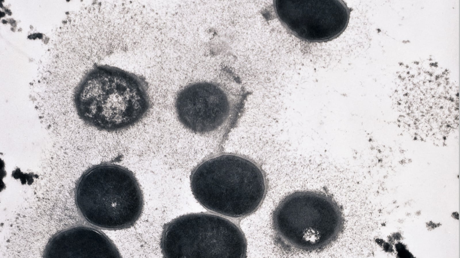 articles/2012/09/28/new-york-s-meningococcus-scare-outbreak-in-gay-community/meningitis-gay-community-sepkowitz_jqazkg