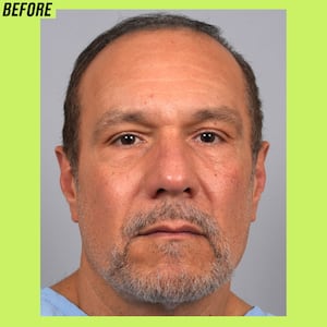 Male hair transformation before and after