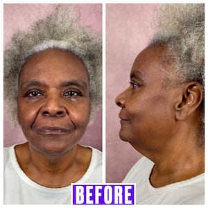 For The Looker - This Surgeon Gave His Mother a Facelift and the Results Went Viral