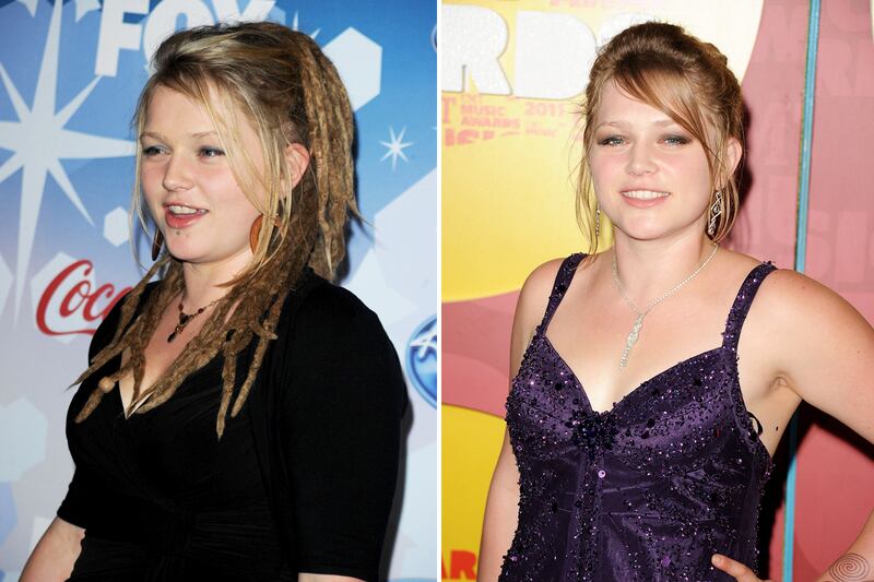 galleries/2012/06/08/jewel-lindsay-lohan-more-stars-who-fixed-their-teeth-photos/celeb-teeth-crystal-bowersox_kinbw1