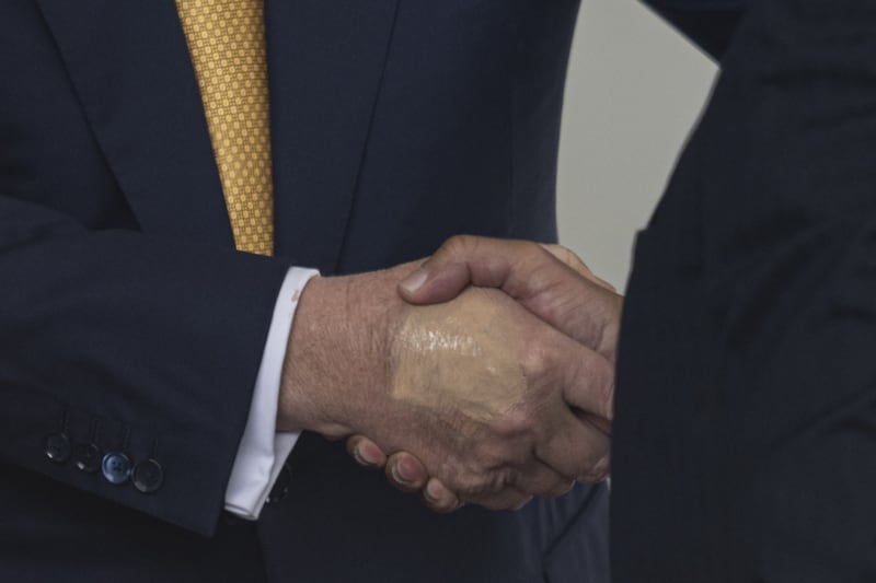 A make-up covered bruise is seen on President Trump's right hand.