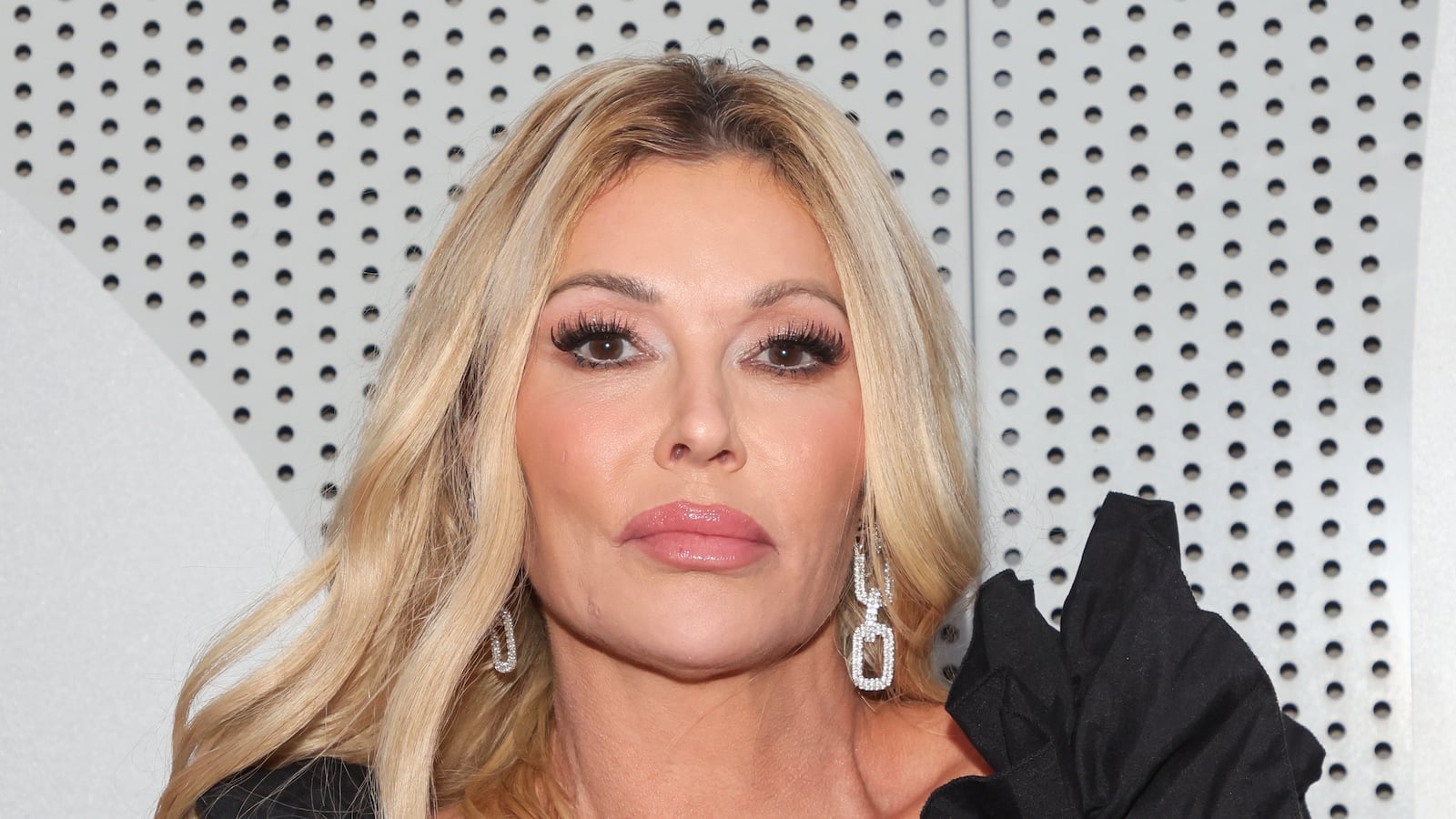 Brandi Glanville says doctors have blamed a parasite for her swollen face.