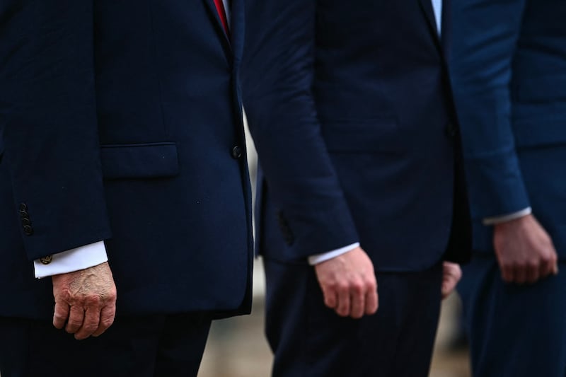 Trump bruised hand