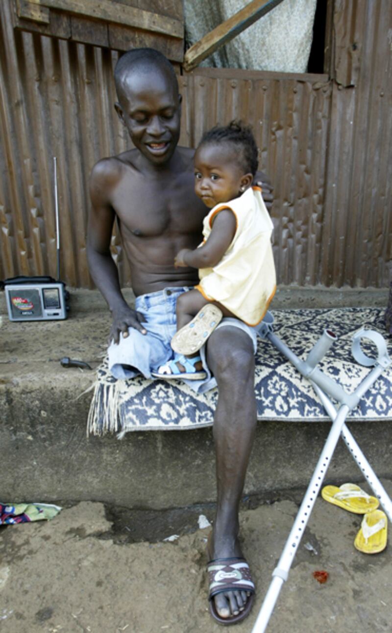 galleries/2012/04/26/charles-taylor-verdict-liberian-warlord-s-alleged-atrocities-photos/liberia-amputee-survivor-2006_qod2o1