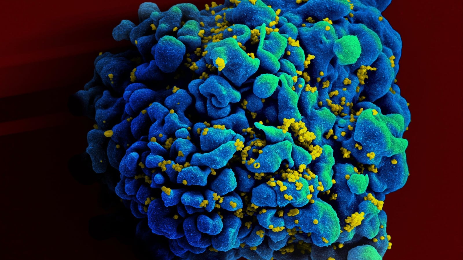 hiv_cell_zaeykn