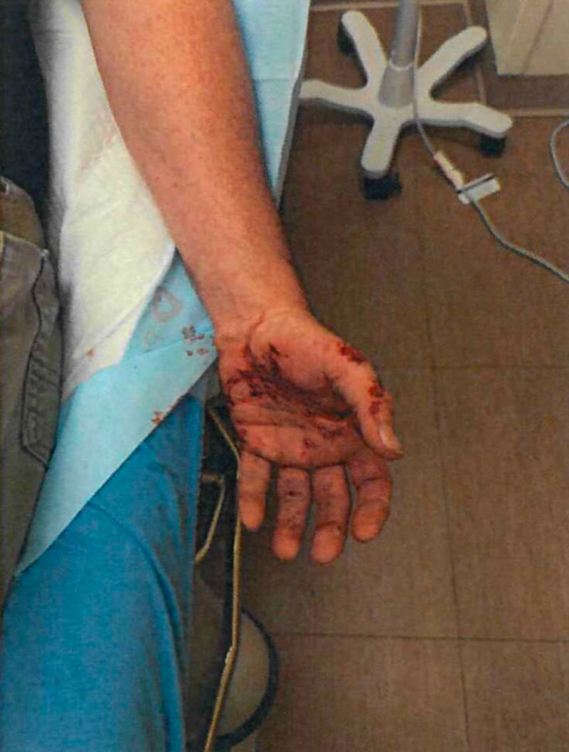 Jonathan Ross was hospitalized in June 2025 after he was dragged by a car during an immigration operation, a federal complaint says.