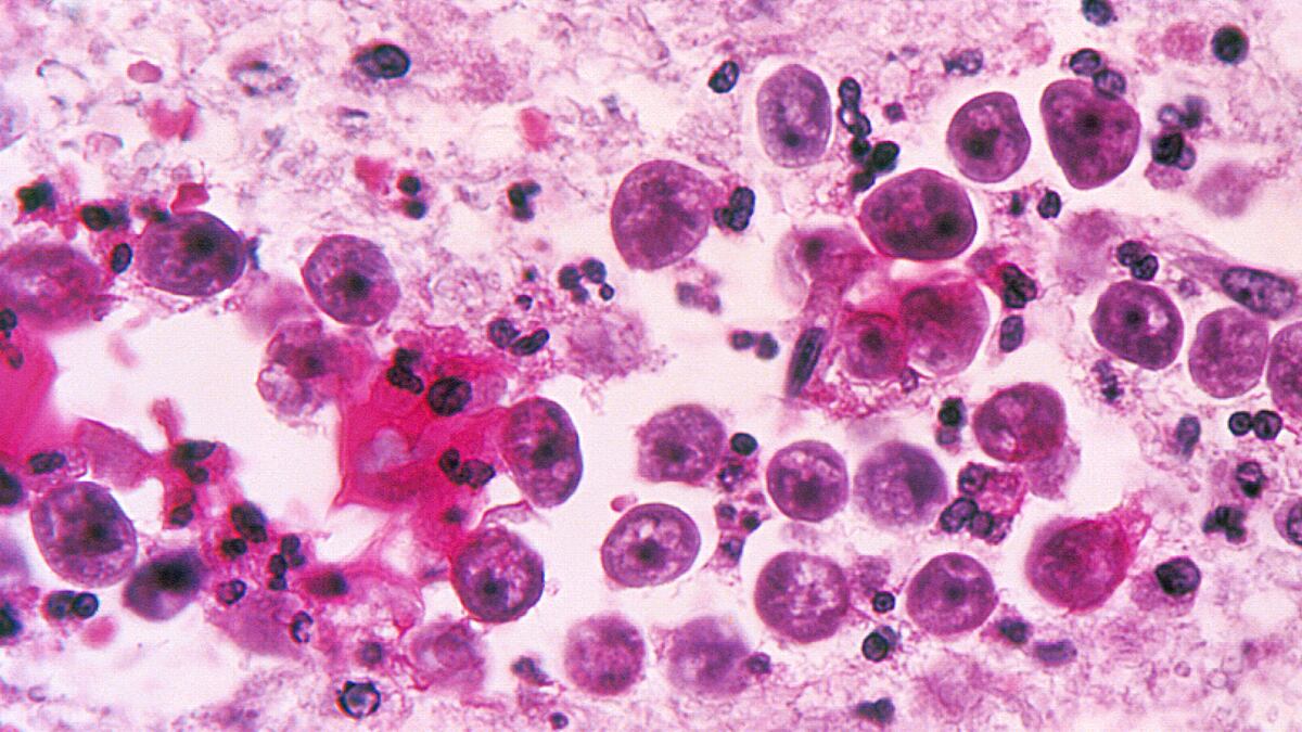 articles/2011/12/23/brain-eating-amoeba-cases-puzzle-and-worry-scientists/neti-pots-amoeba-begley_ewodhz