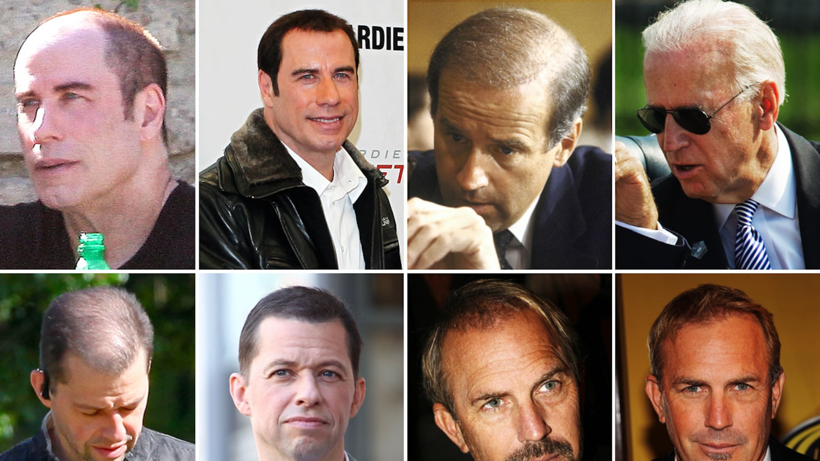 galleries/2011/09/27/stars-who-suddenly-have-hair-travolta-costner-alexander-cryer-photos/stars-who-suddenly-have-hair-gal-tease_ngami0