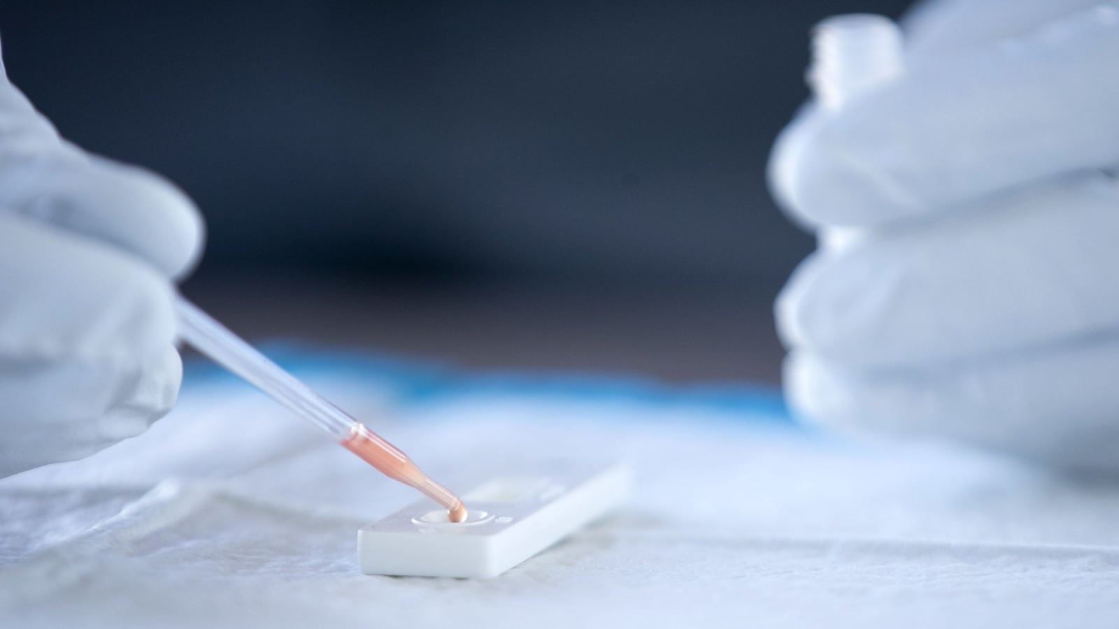 2020-04-29T031459Z_672679711_MT1USATODAY14267645_RTRMADP_3_DROPS-OF-BLOOD-FROM-A-PHOENIX-FIRE-DEPARTMENT-FIRST_grrvgi