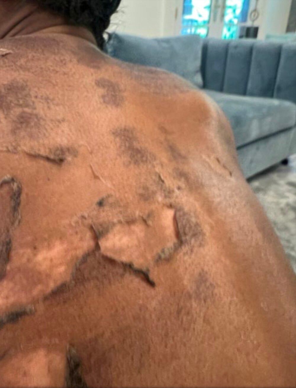 Shamea Morton's back after the alleged malpractice.