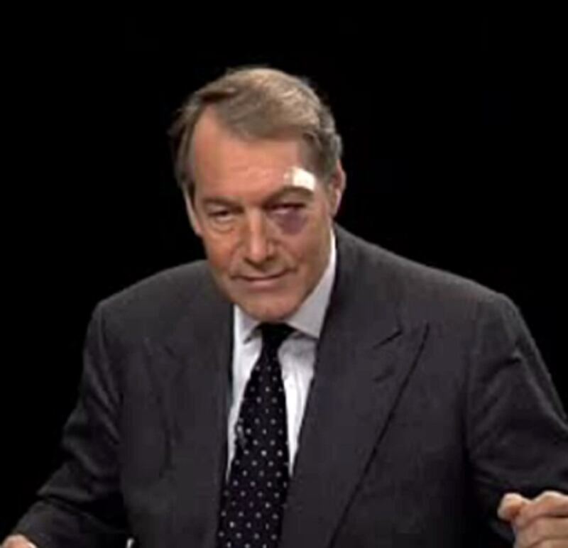 galleries/2012/06/13/stars-with-shiners-lady-gaga-reese-witherspoon-robert-downey-jr-madonna-others/rose-stars-with-shiners_qqceue