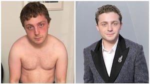 Jake Shane before/after