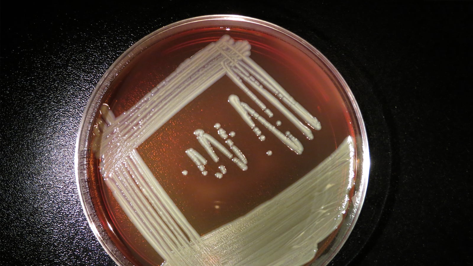 articles/2016/03/22/what-is-elizabethkingia-the-strange-blood-infection-gripping-the-midwest/160321-allen-blood-infection-tease_fd40rl