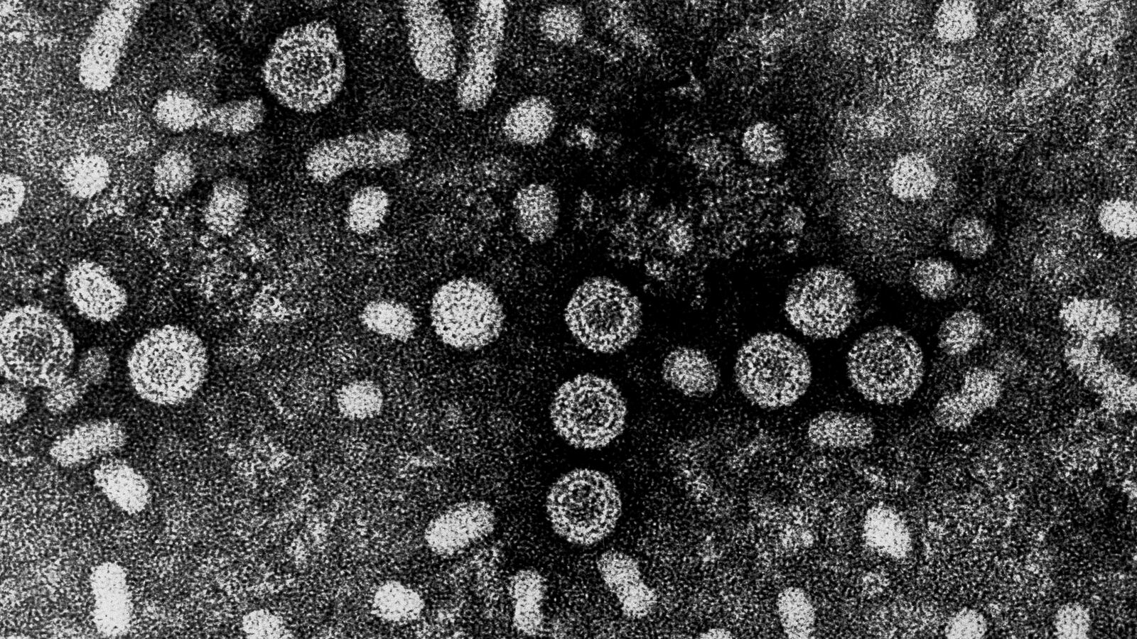 cheats/2013/04/08/hepatitis-a-scare-at-nyc-restaurant/130408-hepatitis-a-scare-cheat_ruetgn