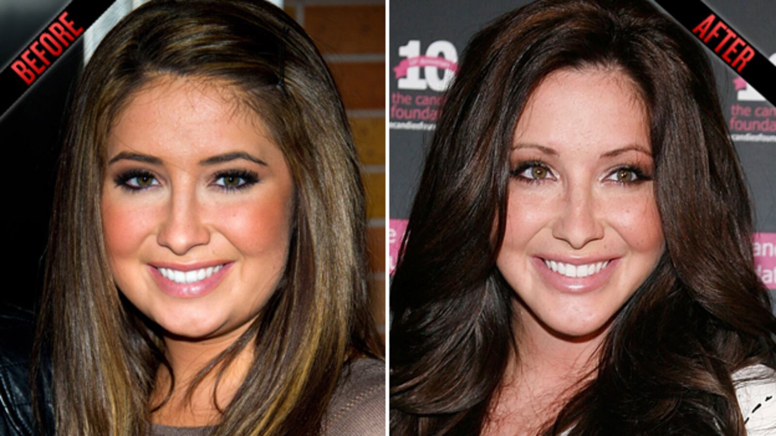 galleries/2010/07/19/too-young-for-botox/too-young-for-botox---bristol-palin_s4cfor